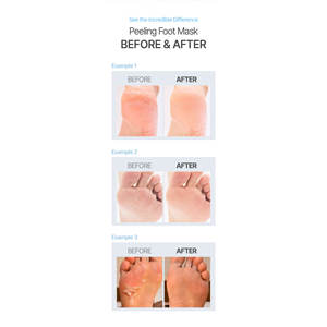 Mascarilla de Lujo para Pies SALM MOA, Paquete de Mascarillas Exfoliantes No Tejidas de Absorción Rápida, Esencia Reparadora para Talones Secos, OEM ODM, Cuidado de la Piel con Efecto Peeling - Product Image 6