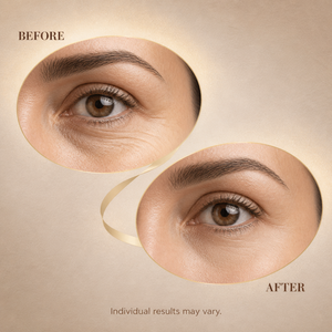 Crème Contour des Yeux Anti-Rides Effet Tenseur Instantané et Raffermissant à l'Acide Ascorbique et aux Protéines 20g Naturelle Marque Blanche OEM - Product Image 5