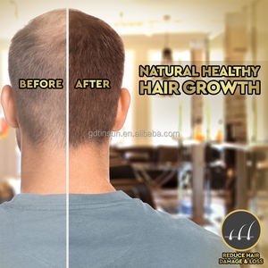 OEM/ODM ghk-cu mavi bakır peptid saç büyüme Serum saç dökülmesi tedavisi saç büyüme yağı siyah kadınlar için - Product Image 5