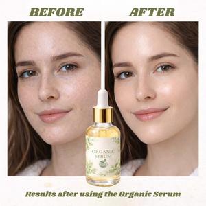 Sérum visage premium à l'acide hyaluronique et au bakuchiol, éclaircissant, anti-acné, anti-âge, pour une peau éclatante, blanchissant, enrichi en vitamine C - Product Image 5