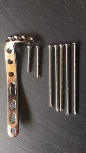 Mini Placa Ósea, Instrumentos Quirúrgicos Ortopédicos, Placa en L de Compresión con Bloqueo de 4 mm, Material de Acero Inoxidable, Quirúrgico ORTOPÉDICO - Product Image 6