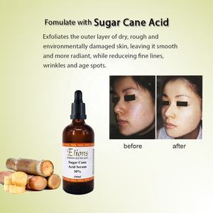 Gel Exfoliante para el Acné y las Espinillas con 30% de Ácido de Caña de Azúcar A.H.A, Reduce los Poros, Limpieza Profunda, Aclara la Piel, Suero Anti-Manchas Oscuras - Product Image 3