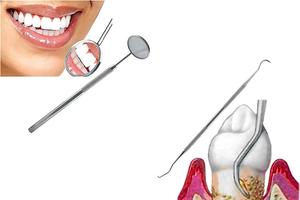 Mejor Precio SAAR GLOBAL SURGICAL INSTRUMENTS Kit de Examen Dental 5 Piezas, Kit de Instrumentos de Cuidado Bucal, Juego de Raspador, Sonda y Limpiador Dental - Product Image 6