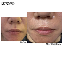 Suero de péptidos para lifting facial, potenciador de colágeno, reafirmante avanzado de la piel, hidratante antiarrugas