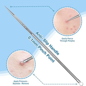 11cm High Carbon Steel Face Comedone <b>Extractor</b> <b>Tool</b> | Professional Double-Ended Acne & <b>Blackhead</b> Remover - Product Image 2