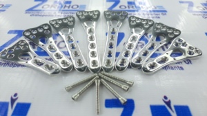 Juego de tornillos y placas de bloqueo volar para radio distal de alta calidad SS 316L, 2-10 orificios, izquierda/derecha, 92 piezas, modelo manual ORTHO ZE ORZ-OP-0010 - Product Image 1
