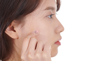 แผ่นปิดสิวไฮโดรคอลลอยด์ 12 มม. |   ผลิตภัณฑ์รักษารอยดำและปกปิดรอยแผลแบบเนียนเรียบ |   เกาหลี OEM - Product Image 4