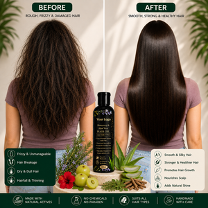 Aceite Capilar de Romero y Aloe Vera con Tu Logotipo, para Todo Tipo de Cabello, Aceite Reparador Natural a Base de Hierbas, 100 ml - Product Image 1