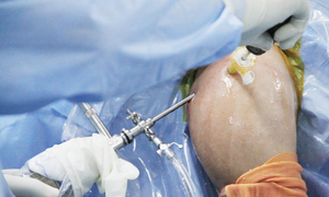 Kit de draps chirurgicaux pour arthroscopie de l'épaule, marque VT Healthcare, certifié ISO CE MDR, durée de conservation de 3 ans, jetable, à usage unique - Product Image 2