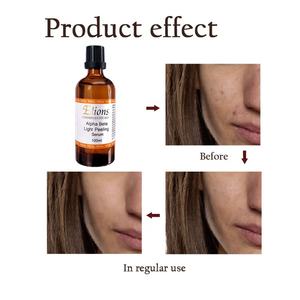 Gel Químico Profesional para Exfoliar la Piel, Aclarar Manchas Oscuras, Iluminar el Tono, Minimizar Poros, Acné, Antienvejecimiento, Sérum Exfoliante Profundo - Product Image 3