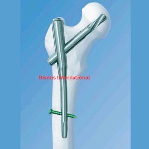 Bisons wholesale Proximal Femoral Rotational Stability Nail PFRN 130° Orthopedic Implant - Product Image 2