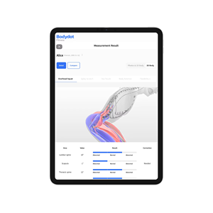 Analizador Corporal Inteligente Bodydot BDF1000 con IA, Marco Flexible de Aleación de Aluminio, No Plegable, Seguimiento de Postura Corporal Completa, 35x35x134cm - Product Image 1