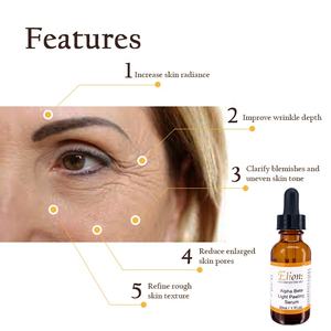 Suero Químico de Alta Potencia al 32% para el Rostro, Antiarrugas, Blanqueador, Mejora la Luminosidad de la Piel, Atenúa Manchas Oscuras, Acné, Iluminador - Product Image 4