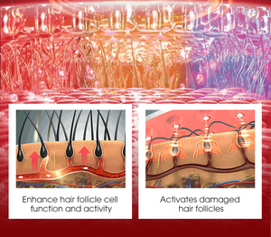 Dispositivo de Terapia de Luz Roja para el Crecimiento del Cabello, Cobertura Total del Cuero Cabelludo, Láser Médico de 650nm, Recargable por USB, de Escritorio - Product Image 4
