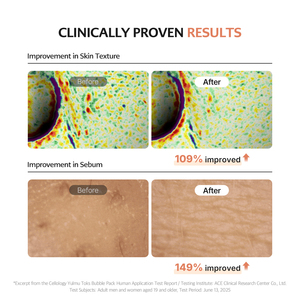 เซลโลโลจี ยูลมู ทอกซ์ บับเบิ้ลแพ็ค 100 ก |   โคอิกซ์ ซีด พอร์ คลีนซิ่ง เฟซ มาส์ก สำหรับผู้หญิง ขจัดความมัน ผิวที่ตายแล้ว ผลัดเซลล์ผิวทุกสภาพผิว - Product Image 5