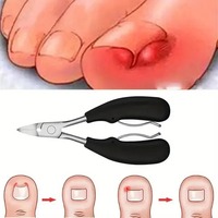 Kit de coupe-ongles pour ongles incarnés et épais en acier inoxydable, robuste, avec coupe-ongles courbé de qualité podologique et coupe-peaux mortes