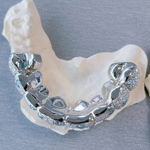 Grillz de Moissanita Personalizados, Bicolor Azul y Blanco, de Plata 925, con Incrustaciones de Piedras, que Pasan la Prueba del Diamante, Joyería Hiphop para Dientes - Product Image 2