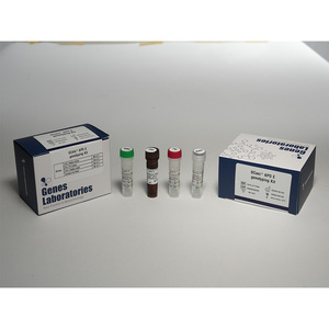 [Genes Lab] Kit de PCR en Tiempo Real Gcdia HLA-B27, Kit de Diagnóstico de Genotipificación por PCR en Tiempo Real para la Evaluación del Riesgo de Alzheimer en Sangre Completa - Product Image 3