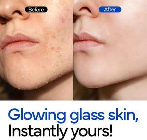 IVOSKIN Rice Niacinamide Gentle Foam Bubble <b>Toner</b> PHA Pore Shrinking Lightening Moisturizing Anti-aging Luxury Hydration <b>Skin</b> - Product Image 2