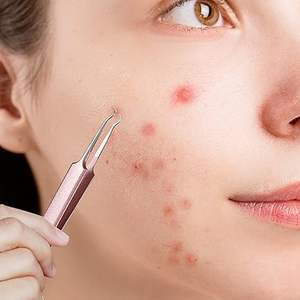 แหนบกำจัดสิวหัวดำแบบมืออาชีพ แหนบเข็มกำจัดสิว แหนบปลายโค้ง แหนบกำจัดสิวหัวดำและสิวหัวขาว - Product Image 4