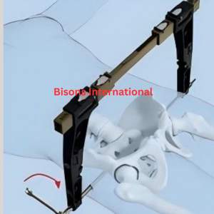 BISONS Instrumento de Fijación Externa con Abrazadera en C Pélvica Manual de Acero Inoxidable para Estabilización Pélvica de Emergencia - Product Image 2