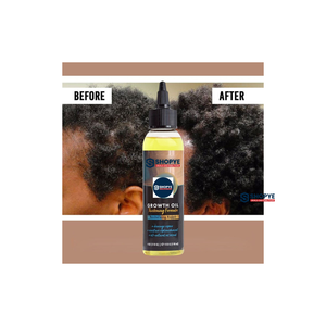 Huile capillaire bio à base de plantes, 100 % naturelle et végétalienne, pour un traitement profond du cuir chevelu, renforce les cheveux faibles, lisse et répare les cheveux. - Product Image 4