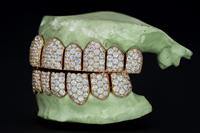 Vente en gros Orave Luxury Christian Grillz dentaires en argent 925 personnalisés avec diamants VVS de laboratoire taille brillant, entièrement sertis, numérisation dentaire 3D, processus rapide