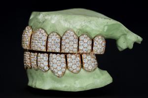 Venta al por mayor de Grillz dentales de plata 925 personalizados con diamantes VVS cultivados en laboratorio, con incrustaciones de diamantes, escaneo dental 3D, proceso rápido y que pasan la prueba del probador de diamantes - Product Image 2