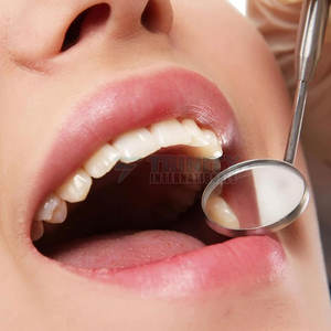 High Quality Mouth <b>Mirror</b> Dental Stainless Steel Mouth <b>Mirror</b> Professional Dental Tools Mouth <b>Mirror</b> - Product Image 3