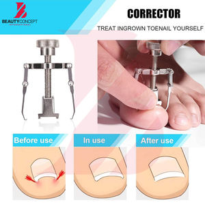 Kit personnalisé d'élimination des ongles incarnés, outils de podologie, coupe-ongles, lime à ongles, ciseaux à cuticules, instruments de soin des pieds - Product Image 4