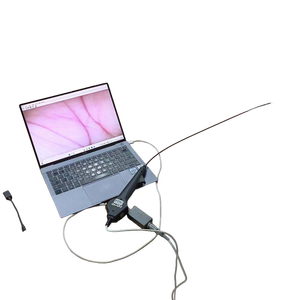 Haiye Medical Disposable Urescope <strong>Flexible</strong> Video <strong>Ureteroscope</strong> Digital Urological <strong>Ureteroscope</strong> - Product Image 4
