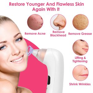 Estrattore Elettrico per Punti Neri e Comedoni, Aspiratore per Punti Neri e Rimozione Acne in Un Unico Dispositivo - Product Image 2