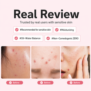 Loción Calmante de Árbol de Té Dr. Deep, para Piel Sensible, Hidratante, Equilibra la Grasa, Calma el Acné, Cuidado Facial Coreano, 120 ml - Product Image 6