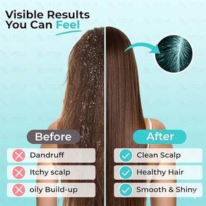 OTICA Soft Silicone Scalp Massager Shampoo <b>Brush</b> Hair Scalp Scrubber for Deep Cleansing, Oil Massage, Wet & Dry Use for scalp - Product Image 5