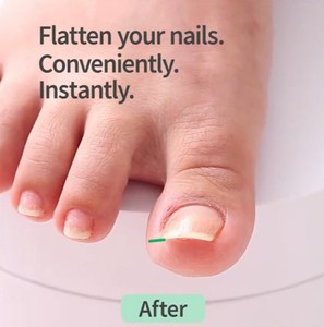 Un gel facile à utiliser pour les ongles incarnés, qui s'applique comme un vernis coloré classique et peut être utilisé en parallèle à la couleur standard des ongles. - Product Image 1