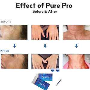 Ampoule liquide hydratante coréenne Pure Pro PN Skin Booster 2,2 ml pour la réparation de la peau du visage, soin du teint, fermeté, éclat, solution beauté - Product Image 2