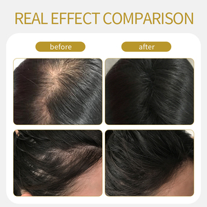 Champú y Acondicionador Herbal Profesional para Salón de Belleza, Set de Cuidado Capilar OEM Personalizado - Product Image 3