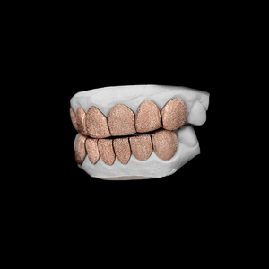 Dientes de metal dorados y plateados atractivos al por mayor Grillz con diamante tachonado con moissanita VVS chapado en oro para bodas y regalos - Product Image 6
