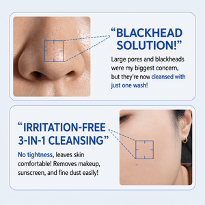 Limpiador Facial de Agua Hipermineralizada 3 en 1, Espuma Limpiadora Profunda, Desmaquillante, Eliminación de Polvo Fino, Cuidado de los Poros, Lavado Suave - Product Image 5