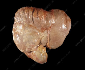 Vejiga Biliar de Res Natural, Vejiga Biliar de Buey, Extracto Animal a Granel al por Mayor - Product Image 4