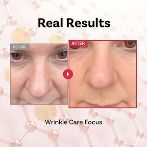 [APOTHE] Crema Reparadora de Tensión con Péptido 11 Botulinum 50ml, Uso Diario, en Tarro, Elasticidad, Hidratante, Nutritiva, Loposoma, Para Todo Tipo de Piel - Product Image 2