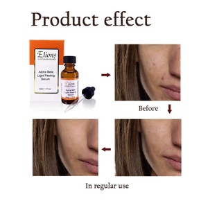 Exfoliante profesional OEM para la piel con 32% de A.H.A. y B.H.A., ilumina el tono de la piel, minimiza los poros, anti-manchas oscuras, sérum blanqueador exfoliante. - Product Image 3