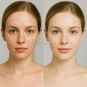 Fabriekslevering Hoogwaardig Verhelderend Huid Alpha Arbutin Poeder Cosmetische Kwaliteit Alpha Arbutin Poeder - Product Image 5