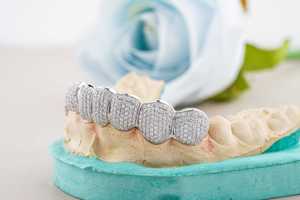 Dentaduras de diamantes de plata de ley 925 con moissanita de corte redondo, joyería brillante para dientes, accesorio de moda hip hop, lujo dental - Product Image 6