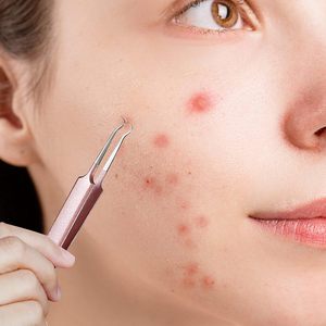 3PCS Stainless Steel <b>Blackhead</b> Tweezers Pimple <b>Extractor</b> <b>Tool</b> Curved Bend Tweezers for Remove Zit Whitehead Skin Care - Product Image 5