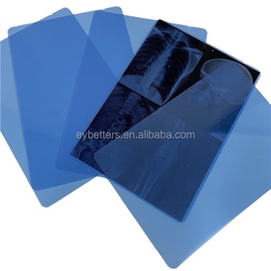 Filme de Raio-X Médico Sob Medida, Desconto para Pedidos em Lote, Ideal para Fornecedores de Equipamentos Médicos - Product Image 2