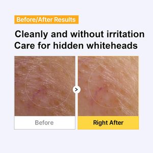 [APOTHE] Exo Some Anti-Pollution Visage Tonifiant 60 Tampons Feuilles Hydratant Éclaircissant Exfoliant Éclaircissant Tous Types de Peau - Product Image 5
