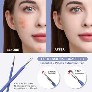 Extractor de Puntos Negros y Espinillas 2 en 1 con Limpiador de Poros para Eliminar Comedones del Rostro y Nariz - Product Image 4