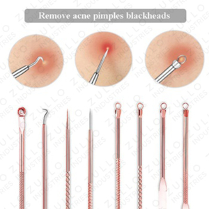 Premium 4 Piece Acne Extractor Tool Set Stainless Steel Blackhead Remover Kit for Facial Pore Cleansing Care - Product Image 5