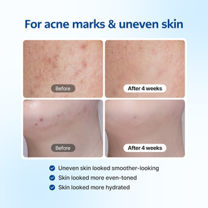 เซลโลโลจี บลู อีเรเซอร์ ครีม 50 มล. |   มอยเจอร์ไรเซอร์บำรุงผิวหน้ากลางคืน ช่วยเติมความชุ่มชื้น ปรับผิวกระจ่างใส ด้วยไนอะซินาไมด์และไฮยาลูรอนิค แอซิด สำหรับผู้หญิง - Product Image 6